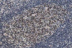 ABIN6267545 at 1/100 staining human Lymphoma tissue sections by IHC-P.