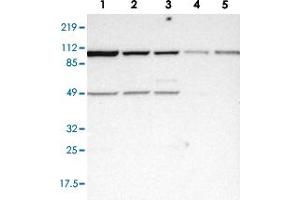 Western blot analysis of Lane 1: RT-4, Lane 2: EFO-21, Lane 3: A-431, Lane 4: Liver, Lane 5: Tonsil with ASCC2 polyclonal antibody  at 1:250-1:500 dilution.