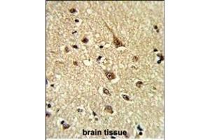 Immunohistochemistry (Paraffin-embedded Sections) (IHC (p)) image for anti-Glyoxalase I (GLO1) (AA 23-51), (N-Term) antibody (ABIN390591)