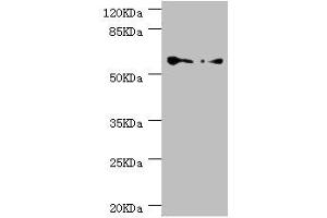 Western blot All lanes: CCT5 antibody at 1. (CCT5 Antikörper  (AA 1-270))