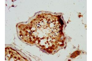 IHC image of ABIN7173496 diluted at 1:200 and staining in paraffin-embedded human testis tissue performed on a Leica BondTM system. (NSUN2 Antikörper  (AA 432-509))