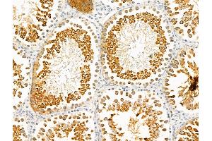 anti-Interleukin 17 Receptor E (IL17RE) (Internal Region) antibody