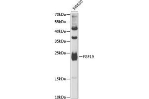 Western blot analysis of extracts of SW620 cells, using FGF19 antibody (ABIN6127925, ABIN6140595, ABIN6140596 and ABIN6222270) at 1:1000 dilution. (FGF19 Antikörper  (AA 25-216))