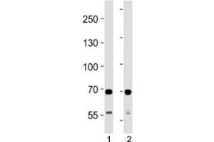 SDHA antibody western blot analysis in 1) human HeLa and 2) mouse C2C12 lysate. (SDHA Antikörper  (AA 577-605))