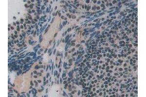 Immunohistochemistry (IHC) image for anti-Endoglin (ENG) (AA 27-137) antibody (ABIN7432973)