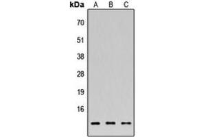 Western blot analysis of 42096 expression in HEK293T (A), NS-1 (B), H9C2 (C) whole cell lysates. (FAM215A Antikörper  (C-Term))