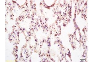 Formalin-fixed and paraffin embedded rat lung tissue labeled with Anti-PPIG Polyclonal Antibody, Unconjugated (ABIN700450) at 1:200, followed by conjugation to the secondary antibody and DAB staining (PPIG Antikörper  (AA 351-450))