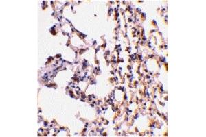 Immunohistochemistry (IHC) image for anti-BH3 Interacting Domain Death Agonist (BID) (C-Term) antibody (ABIN1030296) (BID Antikörper  (C-Term))