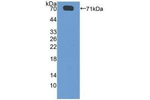 Detection of Recombinant SGSH, Human using Polyclonal Antibody to N-Sulfoglucosamine Sulfohydrolase (SGSH) (SGSH Antikörper  (AA 21-389))