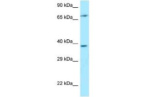Western Blotting (WB) image for anti-Thymocyte Selection Associated (THEMIS) (C-Term) antibody (ABIN2789620) (THEMIS Antikörper  (C-Term))