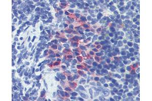 Anti-CD11b antibody IHC of mouse spleen. (CD11b Antikörper)