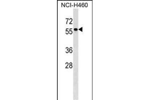 TYRP1 Antibody (Center) (ABIN1538332 and ABIN2849139) western blot analysis in NCI- cell line lysates (35 μg/lane). (Tyrosinase-Related Protein 1 Antikörper  (AA 341-371))