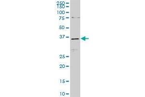 CDX4 monoclonal antibody (M06), clone 3F3. (CDX4 Antikörper  (AA 71-170))