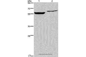 Western blot analysis of Raji and 293T cell, using IMPDH1 Polyclonal Antibody at dilution of 1:500 (IMPDH1 Antikörper)