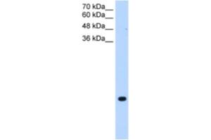 Western Blotting (WB) image for anti-Transmembrane Protein 75 (TMEM75) antibody (ABIN2463990) (TMEM75 Antikörper)
