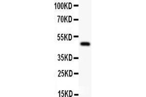 Western Blotting (WB) image for anti-Transcription Factor AP-2 alpha (Activating Enhancer Binding Protein 2 Alpha) (TFAP2A) (AA 1-166) antibody (ABIN3043420)