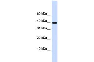 WB Suggested Anti-LECT1 Antibody Titration:  0. (LECT1 Antikörper  (N-Term))