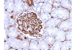 Immunohistochemistry (IHC) image for anti-Nestin (NES) (AA 698-844) antibody (ABIN6939087)