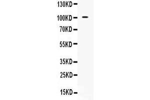 Western blot analysis of NARG1 expression in 293T whole cell lysates ( Lane 1). (NAA15 Antikörper  (N-Term))