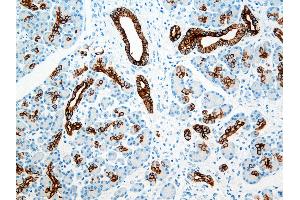 Immunohistochemistry (IHC) image for anti-Keratin 8/18/19 (KRT8/18/19) antibody (ABIN108431) (Keratin 8/18/19 Antikörper)