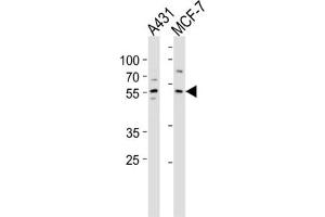 Western Blotting (WB) image for anti-Kruppel-Like Factor 4 (Gut) (KLF4) antibody (ABIN2996460)
