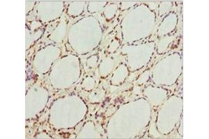 Immunohistochemistry of paraffin-embedded human thyroid tissue using ABIN7154750 at dilution of 1:100 (GNB1L Antikörper  (AA 1-327))