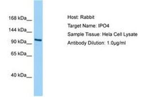 Image no. 1 for anti-Importin 4 (IPO4) (AA 468-517) antibody (ABIN6750201) (Importin 4 Antikörper  (AA 468-517))