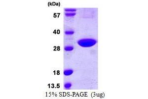 SDS-PAGE (SDS) image for CINP (CINP) (AA 1-212) protein (His tag) (ABIN667492)