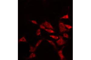 ABIN6274897 staining Hela cells by IF/ICC.