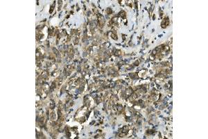 IHC analysis of TRIM25 using anti-TRIM25 antibody (ABIN7599495).