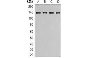 Western blot analysis of ALPK1 expression in LO2 (A), HCT116 (B), COLO205 (C), HepG2 (D) whole cell lysates. (ALPK1 Antikörper  (N-Term))
