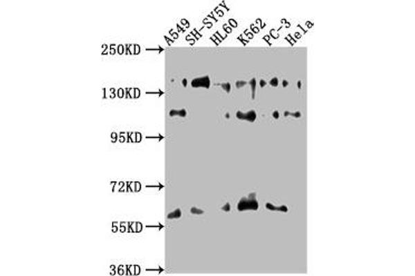 SOS2 Antikörper  (AA 187-404)