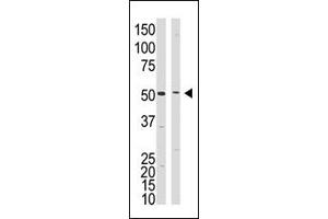 Western Blotting (WB) image for anti-Presenilin 1 (PSEN1) (C-Term) antibody (ABIN358721) (Presenilin 1 Antikörper  (C-Term))