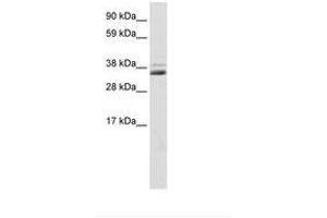 Image no. 1 for anti-Secreted Frizzled-Related Protein 1 (SFRP1) (C-Term) antibody (ABIN202220) (SFRP1 Antikörper  (C-Term))