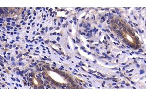 Detection of CASP9 in Rat Uterus Tissue using Polyclonal Antibody to Caspase 9 (CASP9) (Caspase 9 Antikörper  (AA 1-200))