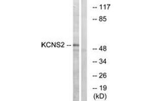 Western blot analysis of extracts from HepG2 cells, using KCNS2 Antibody. (KCNS2 Antikörper  (AA 197-246))
