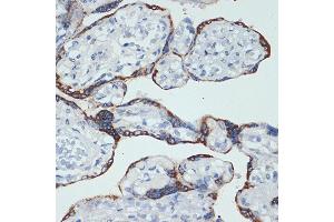Immunohistochemistry of paraffin-embedded human placenta using HSD3B1 Rabbit mAb (ABIN7267801) at dilution of 1:100 (40x lens). (HSD3B1 Antikörper)