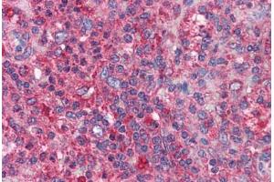 Human Spleen: Formalin-Fixed, Paraffin-Embedded (FFPE) (BIRC3 Antikörper  (AA 314-508))
