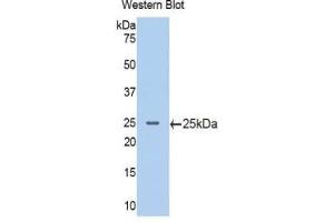 Western blot analysis of the recombinant protein. (PIK3CB Antikörper  (AA 524-703))