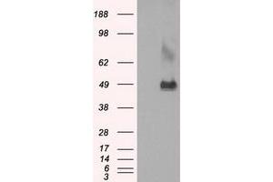 Western Blotting (WB) image for anti-Lysyl Oxidase (LOX) (AA 22-168) antibody (ABIN1491216) (LOX Antikörper  (AA 22-168))
