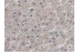 IHC-P analysis of Human Liver Tissue, with DAB staining. (Antizyme Inhibitor 1 Antikörper  (Lys290))
