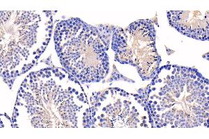 Immunohistochemistry (IHC) image for anti-Caspase 1 (CASP1) (AA 119-296) antibody (ABIN7437506)