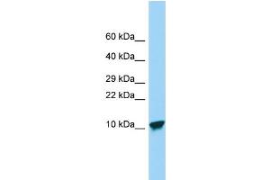 Host: Rabbit Target Name: SPINK9 Sample Type: Placenta lysates Antibody Dilution: 1. (SPINK9 Antikörper  (Middle Region))