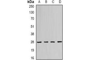 Western blot analysis of RAB11A expression in Jurkat (A), SHSY5Y (B), PC12 (C), mouse spleen (D) whole cell lysates. (RAB11A Antikörper)