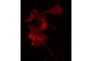 ABIN6274202 staining Hela cells by IF/ICC.