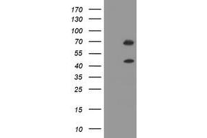 Image no. 1 for anti-tRNA Methyltransferase 2 Homolog A (TRMT2A) antibody (ABIN1501521) (TRMT2A Antikörper)