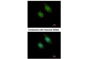 ICC/IF Image Immunofluorescence analysis of methanol-fixed HeLa, using CaMK1D, antibody at 1:500 dilution. (CAMK1D Antikörper)