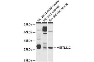 Western blot analysis of extracts of various cell lines, using METTL21C antibody (ABIN6131461, ABIN6143763, ABIN6143764 and ABIN6214649) at 1:1000 dilution. (METTL21C Antikörper  (AA 1-264))
