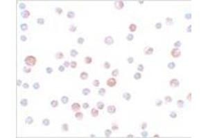 Immunocytochemistry of CaBP7 in HeLa cells with CaBP7 antibody at 4 μg/ml. (CABP7 Antikörper  (N-Term))