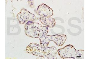 Formalin-fixed and paraffin embedded human placenta labeled with Rabbit Anti ERK1/MAPK3 Polyclonal Antibody, Unconjugated (ABIN736476) at 1:200 followed by conjugation to the secondary antibody and DAB staining (ERK1 Antikörper  (AA 101-200))